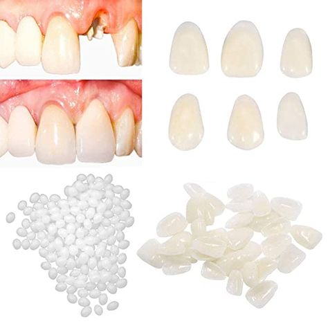 Denture Repairs, Broken Teeth, Tooth Crown, Fix A Zipper, Tooth Filling, Temporary Tooth, Tooth Repair, Dental Restoration, Veneers Teeth