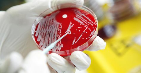 Superbugs are breeding in hospital sink drains. Lung Infection, Contaminated Food, Preventive Medicine, Respiratory Infection, Petri Dish, Raw Dog Food Recipes, Health Policy, Rare Disease, Bacterial Infection