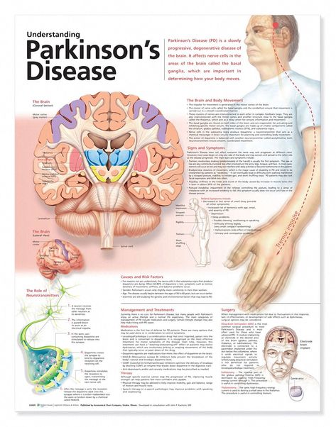 Foot Reflexology Massage, Anatomy Poster, Penyakit Jantung, Medical Posters, Degenerative Disease, Bone Diseases, The Human Brain, Sense Of Smell, Healing Touch