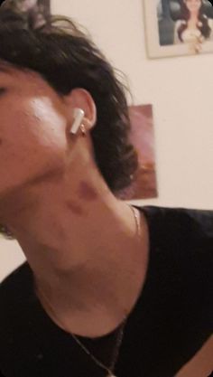 Hickies Neck Guys, Cute Fake Bf Pics, Cute Hickies Neck, Kissing Snap For Boyfriend, Neck Love Bite Boyfriend, Aesthetic Pictures Hickey, Neck Of Hickeys, Guy With Kisses All Over Face, Guy Covered In Kiss Marks