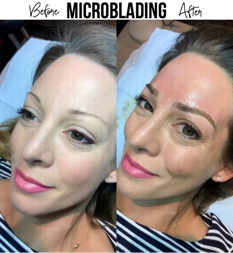 Microbladed eyebrows- this post answers all your questions including: what is it, does it look real, does it hurt, how long does it last, what does it cost?? Tatooed Eye Brows, Eyebrow Examples, Mircoblading Eyebrows, Eyebrows Tattoo, Eyebrow Before And After, Eyebrows Goals, Micro Blading, Eyebrow Microblading, Tweezing Eyebrows