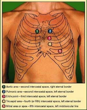 APETM for auscultating the heart! Medical Assistant Student, Nursing Information, Nursing Assessment, Heart Sounds, Nursing Mnemonics, Cardiac Nursing, Nursing School Survival, Nurse Rock, Nursing School Studying