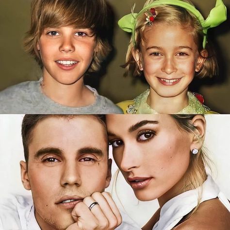 You just can’t apply layers of makeup every time you go out. So you must find a permanent solution for asymmetrical face correction. Hailey Bieber Nose, Asymmetrical Nose, Non Surgical Nose Job, Asymmetrical Face, Hailey Justin, Square Jawline, Justin Bieber Facts, Straight Nose, Justin Hailey