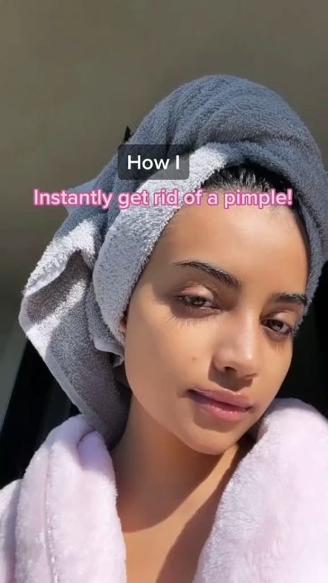 How To Get Rid Of A Pimple Instantly, How To Get White Hands, Head Pimples, Get Rid Of Pimples, Rid Of Pimples, How To Get Rid Of Pimples, Beauty Tips For Glowing Skin, Clear Skin Tips, Healthy Skin Tips