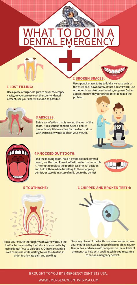 Do you know how to handle a dental emergency? Take a look at this useful infographic! Dentist Crafts, Dentist Poster, Dental Hygienist School, Dental Quotes, Female Dentist, Sensitive Teeth Remedy, Dental Posters, Dental Implants Cost, Dental Facts