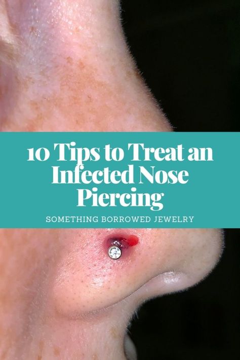 10 Tips to Treat an Infected Nose Piercing Infected Nose Ring, Nose Ring Bump, Infected Nose Piercing, Nose Piercing Infection, Infected Ear Piercing, Nose Infection, Nose Piercing Pain, Nose Piercing Tips, Nose Piercing Scar