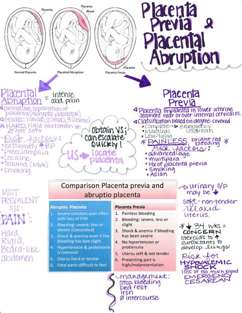 Placental Abruption Nursing, Gynaecology Notes, Labor And Delivery Nurse Cheat Sheet, Nursing Maternity Cheat Sheet, Obstetrics And Gynecology Notes, Maternal Nursing Notes, Midwife School, Ob Nursing Notes, Midwifery Student Notes