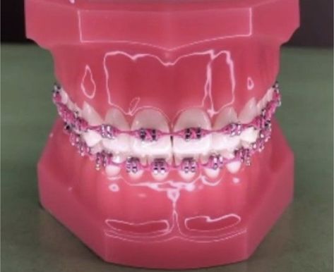 Pink Braces Power Chain, Hot Pink Power Chain Braces, Hot Pink And Light Pink Braces, Rose Pink Braces, Powerchain Braces Colors Pink, Braces Pink Bands, Nice Braces Colors, Braces Hot Pink, Teal Power Chain Braces