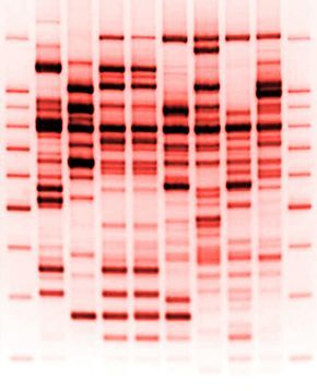 DNA RedHiRes ~ Dna Microscope, Dna Aesthetic, Dna Pattern, Gel Electrophoresis, Dna Facts, Dna Sequencing, Dna Analysis, Dna Art, Scanning Electron Micrograph