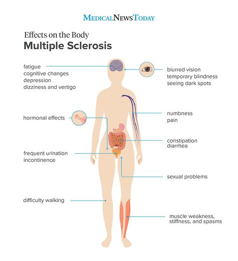 Ms Disease, Multiple Sclerosis Symptoms, Ms Project, Ms Symptoms, Ms Awareness, Auto Immune, Multiple Sclerosis Awareness, Muscle Weakness, Vision Problems