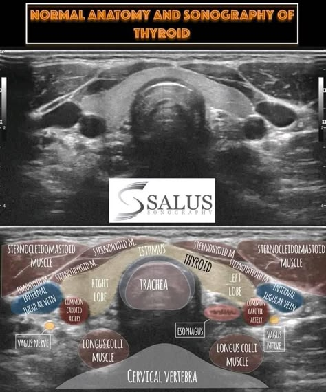 Sonography Humor, Diagnostic Medical Sonography Student, Thyroid Ultrasound, Ultrasound School, Ultrasound Physics, Medical Radiography, Cardiac Sonography, Sonography Student, Vascular Ultrasound