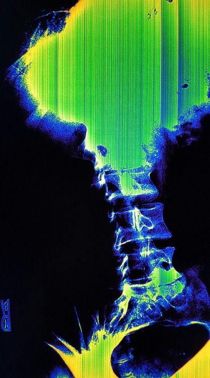 X Ray Aesthetic Wallpaper, Lighting Design Theatre, Xray Art, Trippy Aesthetic, Bio Art, The Moon Is Beautiful, Glitch Art, Dark Photography, Street Photo