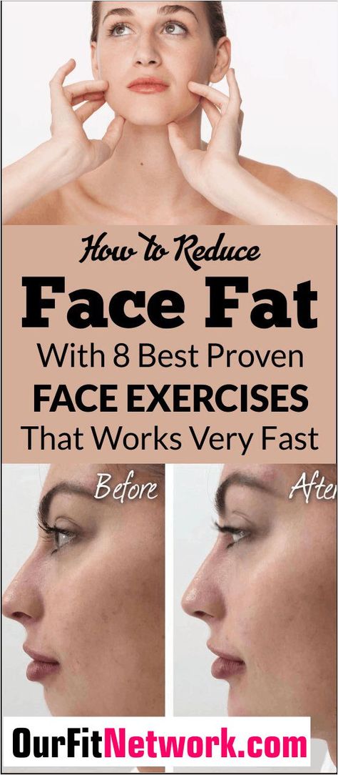 Remove Double Chin, Rid Of Double Chin, Lose Thigh Fat Fast, Reduce Face Fat, Jawline Exercise, Double Chin Exercises, Bursitis Hip, Reduce Double Chin, Chin Exercises