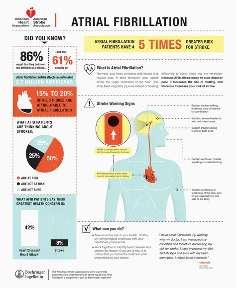 Learn more about atrial fibrillation, how it affects your how and increases your risk of stroke. Nursing Board, Nursing Mnemonics, Cardiac Nursing, Nurse Rock, Atrial Fibrillation, Nursing Tips, Future Nurse, American Heart Association, Emergency Medicine