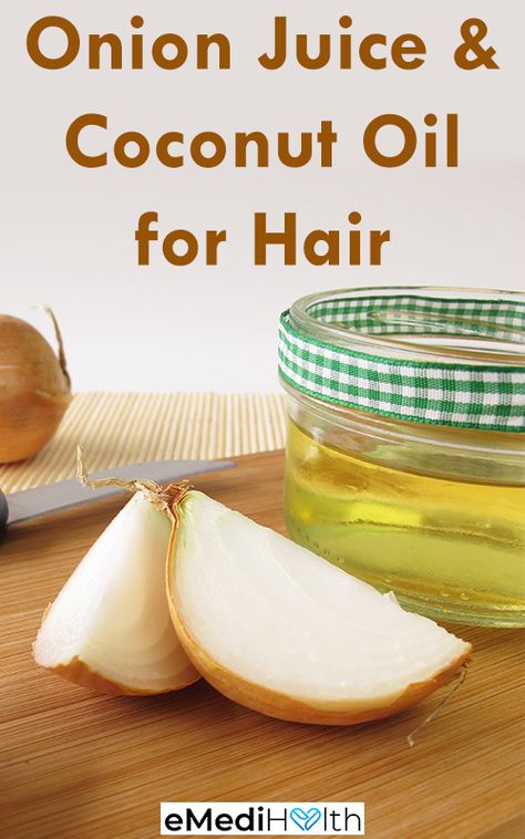 Onion Oil For Hair Growth Diy, Onion Juice For Hair Fall, Coconut Oil And Lemon Juice For Hair, Hair Growth Onion Juice, Onion Oil For Hair, Onion Hair Growth, Onion Juice For Hair, Onion For Hair, Onion Juice