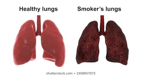 Smokers Lungs, Background Medical, Healthy Lungs, Beauty Packaging, Lungs, 3d Illustration, White Background, Good Food, Medical