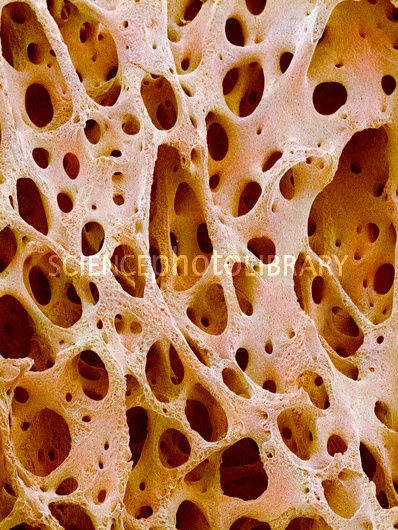 Bone tissue Cancellous Bone, Bone Tissue, Electron Microscope Images, Scanning Electron Microscope, Scanning Electron Micrograph, Microscopic Photography, Micro Photography, Microscopic Images, Electron Microscope