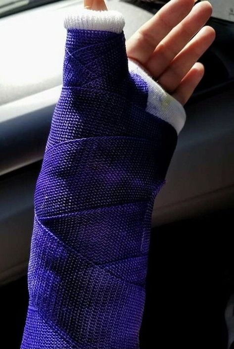 Arm Cast Aesthetic, Hand Fracture Pics, Broken Arm Cast, Cast Covers Arm, Perm Hair Men, Names For Girlfriend, Arm Cast, Cast Covers