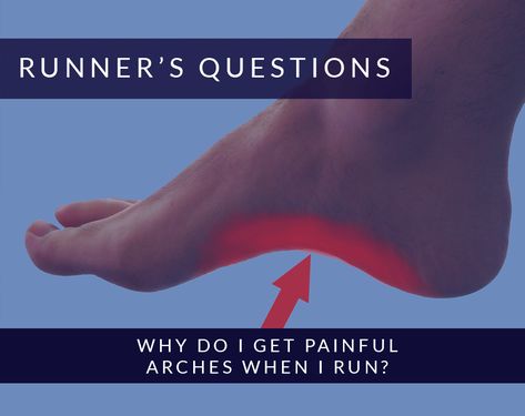 Arch Strengthening Exercises, Fallen Arches Exercises, Running Stretches, Running Techniques, Fallen Arches, How To Tie Shoes, Foot Exercises, Running Injuries, After Running