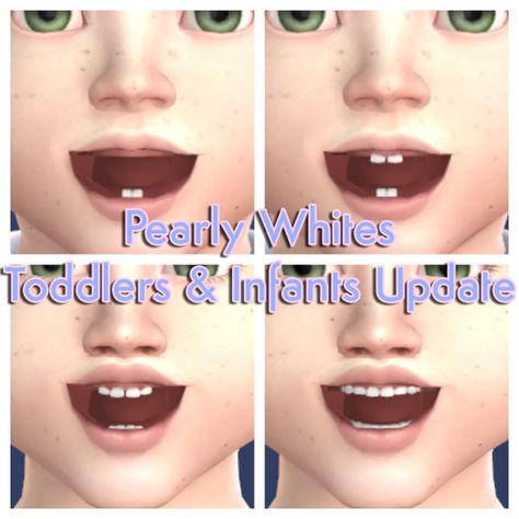 Sims 4 Cc Infant Skin Detail, Sims 4 Toddler Skin Details, Sims 4 Cc Teeth, Ts4 Infants, Sims Infants, Teeth Yellow, Infants Cc, Infant Cc, Sims Baby