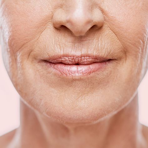 Mouth Wrinkles, Upper Lip Hair, Lip Wrinkles, Botox Injections, Lip Hair, Smooth Lips, Anti Aging Tips, Upper Lip, Prevent Wrinkles