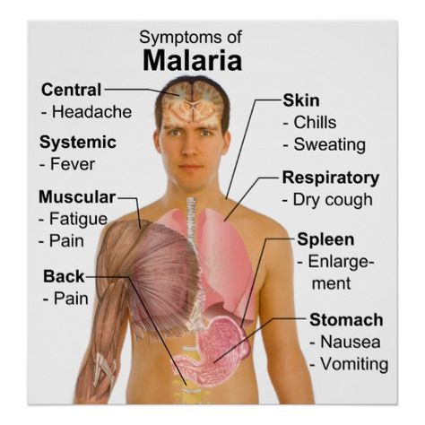 Promoter Blogger: SYMPTOMS OF MALARIA Cardiovascular Surgeon, Malaria Symptoms, Pneumonia Symptoms, Fever Symptoms, Differential Diagnosis, Dry Cough, High Fever, Background Images For Quotes, Growth Hormone