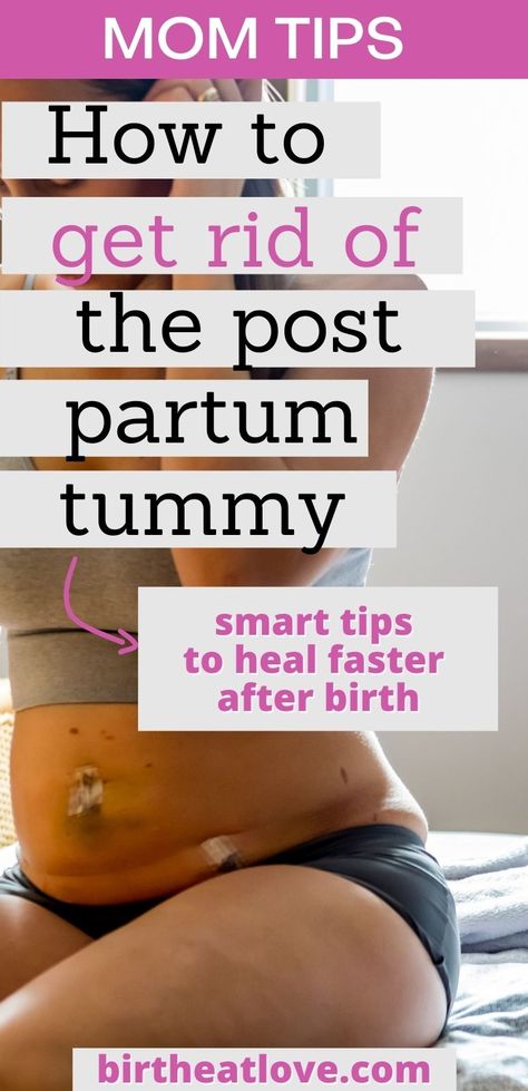 Post Partum Recovery Stretches, 6 Months Post Partum Belly, 1 Week Post Partum Belly, Postpartum Body Care, Postpardom Recovery, Post Partum Supplements, Post Partum Body Pictures, Postpartum Glow Up, Postpartum Makeover