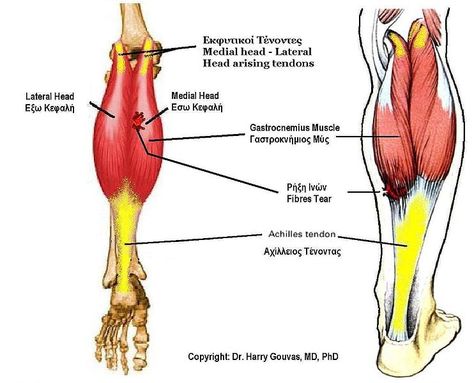 742px-Gastrocnemius_muscle Calf Anatomy, Achilles Tendinopathy, Soleus Muscle, Gastrocnemius Muscle, Athletes Diet, No Meat Athlete, Achilles Tendon, Muscle Workout, Muscle Anatomy