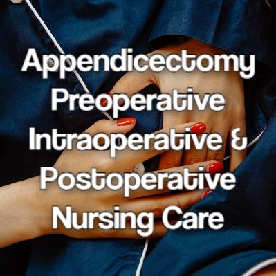 Appendicectomy Nursing Care, Abdominal Pain, Nurse Life, Nursing Students, Nursing