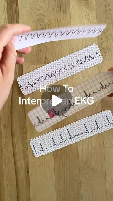 Sush Prusty, MD | ER Physician on Instagram: "Great review from @kristine_nurseinthemaking. Hope you enjoy!!

#emergencymedicine #emergencymedicineresodency #ecg #electrocardiogram #ems #rmergencynedicaltechnitian #paramedic #paramedicstudent #paramedicschool #doctor #doctorsofinstgram #nurses #nursesofinstagram #nursingstudent #nursingschool #nursepractitioner #nursepractitionerstudent #cardiology #cathlab #medicalstudent #medicalschool #medicalresidency #cardiologyfellow #flightmedic #flightnurse #familypractitioner #firstresponder #ekg #ekgtechnician" Nursing Ideas, Paramedic Student, Bsc Nursing, Nurse Practitioner Student, Residency Medical, Nurse Tips, Paramedic School, Flight Nurse, P Wave