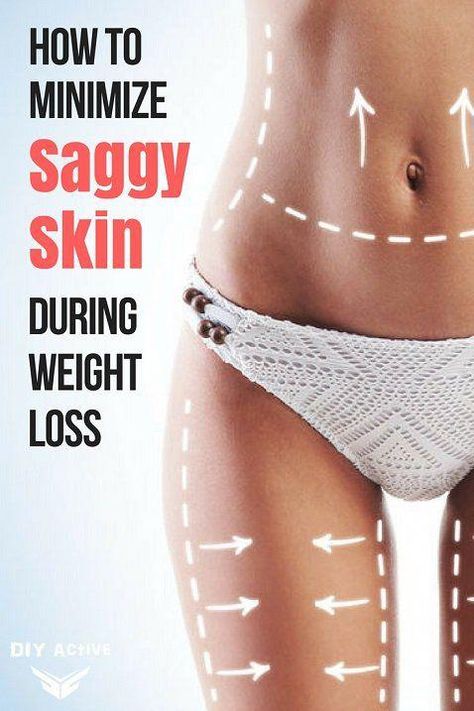 Losing Weight Usually Means Loosening Skin... or Does it? If you’ve ever transformed your body, you know that weight loss can be tough. From cravings to low energy, the journey is never smooth. Of course, the sacrifice is well worth it—after all, if you can change your body, then you can change anything! Looking for a personalized diet and exercise plan? Take this 3-minute quiz. 5 Simple Ways to Prevent Loose Skin (Naturally) But there’s an ugly truth: los #QuickWeightLoss Tighten Loose Skin, Saggy Skin, Loose Skin, Diet Keto, Lose 50 Pounds, How To Slim Down, Skin Tightening, Lose Belly, Lose Belly Fat