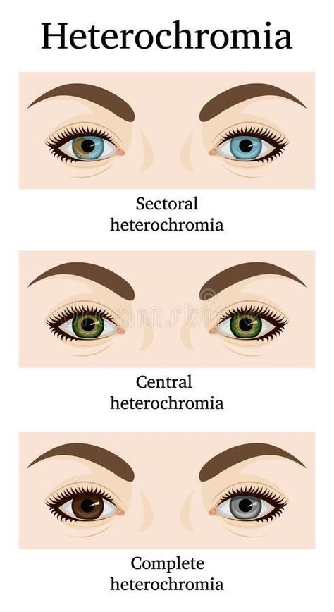 Complete Heterochromia, Heterochromia Iridum, Heterochromia Eyes, Eye Color Chart, Eye Facts, Beautiful Eyes Color, Writing Inspiration Tips, Types Of Eyes, Book Writing Inspiration