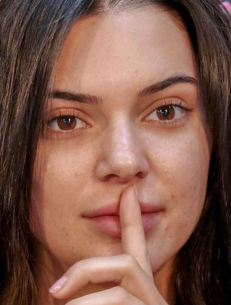 Celebrities With Acne, Kendall Jenner Acne, Kendall Jenner Maquillaje, Acne Positivity, Skin Positivity, Kendall Jenner Face, Celebrity Acne, Kendall Jenner Makeup, Celebs Without Makeup