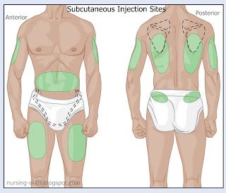 Sub Q Injection Sites Injection Sites Nursing, Injection Sites, Nursing Pharmacology, Subcutaneous Injection, Nursing Skills, Nursing Fun, Nursing Information, Nursing Cheat, Nurse School