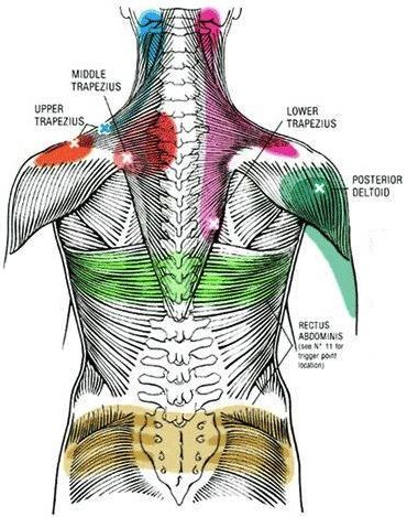 Punkty Spustowe, Myofascial Pain Syndrome, Referred Pain, Muscle Knots, Massage Therapy Techniques, Trigger Point Therapy, Reflexology Massage, Trigger Point, Neck And Shoulder Pain