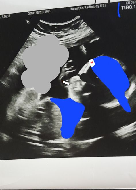 Baby Reveal, A Boy, Gender Reveal, A Girl, Memes, Funny