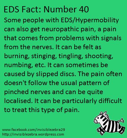 Ehlers Danlos Syndrome Symptoms, Elhers Danlos Syndrome, Ehlers Danlos Syndrome Hypermobility, Ehlers Danlos Syndrome Awareness, Mast Cell Activation Syndrome, Chronic Fatigue Symptoms, Chronic Migraines, Ehlers Danlos, Ehlers Danlos Syndrome