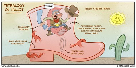 Tetralogy of Fallot | Medcomic Tetralogy Of Fallot, Nursing Interview, Nursing Board, Nursing Mnemonics, Cardiac Nursing, Nursing School Survival, Respiratory Therapy, Nursing School Studying, Nursing School Notes