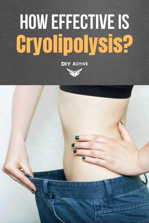 How Effective is Cryolipolysis? | DIY Active Freezing Fat Cells, Lose Love Handles, Lifetime Fitness, Fat Freezing, Sedentary Lifestyle, Cool Sculpting, Fat Removal, Medical Spa, Loose Skin