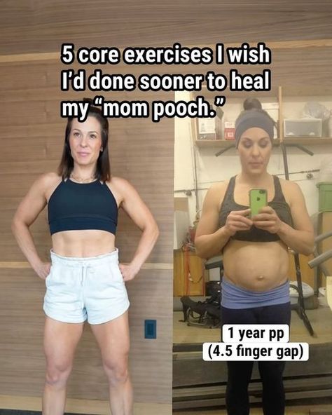 Post C Section Exercise, Postpartum Ab Workout, Mom Pooch, C Section Workout, Postpartum Workouts, Healing Diastasis Recti, Mom Fitness, Diastasis Recti Exercises, Mommy Tummy