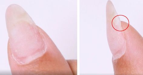 Repairing a cracked nail is simpler than you think Cracked Nail Design, Cracked Nail Repair, Cracked Finger Tips, Fix A Cracked Nail, Fixing Broken Nail, Cracked Nails, Crackle Nails, Nail Repair, Young Nails