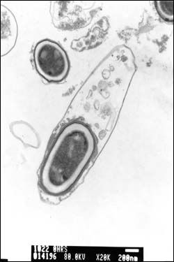 Clostridium Botulinum, University Of Warwick, Cell Division, Severe Storms, Quantum Computer, Food Industry, Life Science, Scientists, Biology