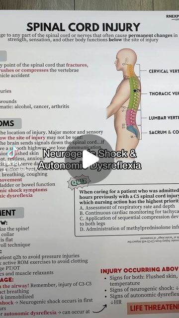 Stephanee Beggs, BSN, RN on Instagram: "Two topics revolving around spinal cord injuries!  A big difference between the two: neurogenic shock shows major PNS symptoms (vasodilation) below the site of injury; autonomic dysreflexia shows SNS symptoms below the site of injury and PNS symptoms above the site of injury ✍🏼" Spinal Injury Nursing, Neurogenic Shock, Autonomic Dysreflexia, Spinal Cord Anatomy, Spinal Cord Injuries, Spinal Injury, Nursing School Survival, School Survival, Spinal Cord