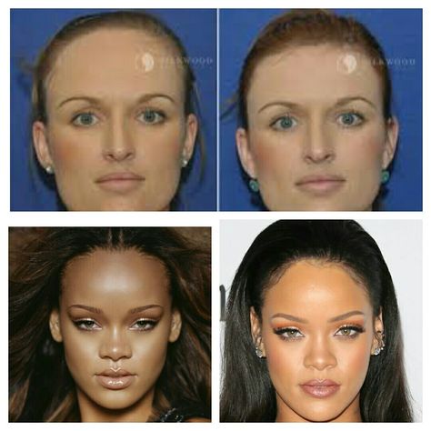 Forehead Reduction Before And After, Rihanna Forehead, Rihanna Natural Hair, Forehead Reduction Surgery, Forehead Reduction, Plan Furniture, Rihanna Hairstyles, Reduction Surgery, Facial Contouring