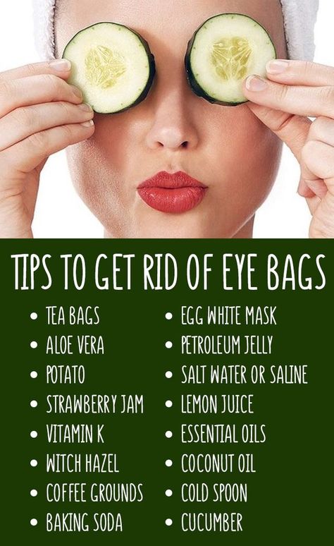 Get Rid Of Eye Bags, Rid Of Eye Bags, Remove Eye Bags, Eye Skin Care, Dark Circles Under Eyes, Under Eye Bags, Beauty Remedies, Skin Care Remedies, Skin Care Recipes