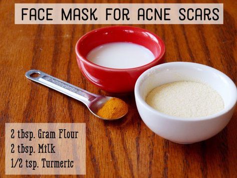 Gram flour and turmeric face mask for acne Gram Flour Face Mask, Flour Face Mask, Tumeric Masks, Face Mask For Acne, Acne Scar Mask, Mask For Acne, Homemade Face Mask, Face Mask For Blackheads, Turmeric Face