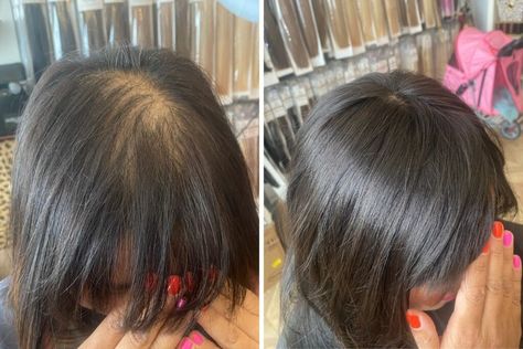 Hairstyles To Hide Thinning Crown, Wedding Hair Thinning Hair, Style Thinning Hair Women, Hair Colour For Thinning Hair, Balding Hairstyles Women, Hairstyles For Front Thinning Hair, How To Hide Thinning Hair For Women, Hairstyle Thinning Hair Women, Thinning Hair Women Haircuts