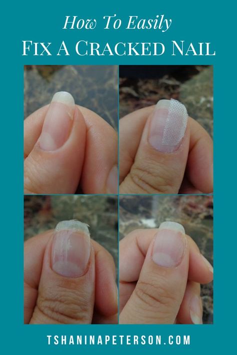 Split Nails Remedies, How To Fix Split Nails, Fix Cracked Nail, Split Nail Repair, Fix Broken Nail, Nail Remedies, Split Nails, Cracked Nails, Nail Room Ideas