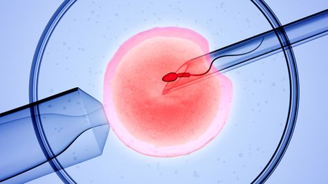 IVF Children Health Risks as They Get Older Blocked Fallopian Tubes, Ivf Cost, Ivf Pregnancy, Assisted Reproductive Technology, Ivf Success, Ivf Clinic, Ivf Center, In Vitro Fertilization, Fallopian Tubes