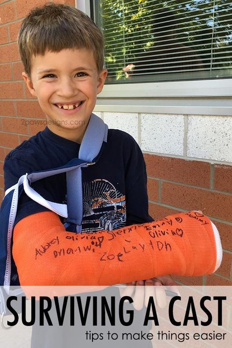 Broken arm? Here are our tips for surviving a cast and making life a little easier while waiting on the bones to heal. Cast Drawing Ideas Arm, Broken Arm Cast, Broken Arm Gift, Cast Covers Arm, Signing Ideas, Cast Drawing, Kids Cast, Get Well Baskets, Long Leg Cast